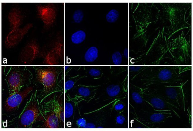 Mouse IgG1 Cross-Adsorbed Secondary Antibody in Immunocytochemistry (ICC/IF)