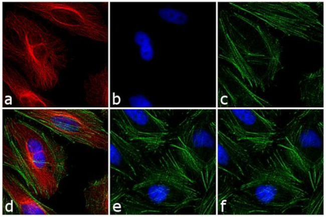 Mouse IgG1 Cross-Adsorbed Secondary Antibody in Immunocytochemistry (ICC/IF)