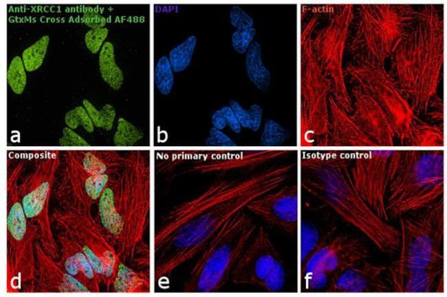 Mouse IgG2a Cross-Adsorbed Secondary Antibody in Immunocytochemistry (ICC/IF)