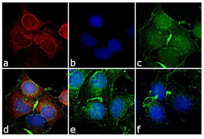 Mouse IgG2a Cross-Adsorbed Secondary Antibody in Immunocytochemistry (ICC/IF)