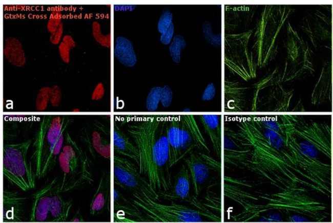 Mouse IgG2a Cross-Adsorbed Secondary Antibody in Immunocytochemistry (ICC/IF)