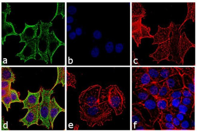 Mouse IgG (H+L) Highly Cross-Adsorbed Secondary Antibody in Immunocytochemistry (ICC/IF)