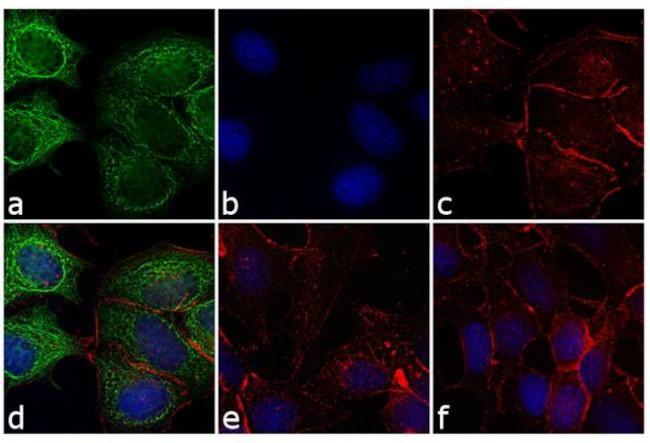 Mouse IgG (H+L) Cross-Adsorbed Secondary Antibody in Immunocytochemistry (ICC/IF)