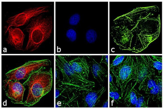 Mouse IgG (H+L) Cross-Adsorbed Secondary Antibody in Immunocytochemistry (ICC/IF)