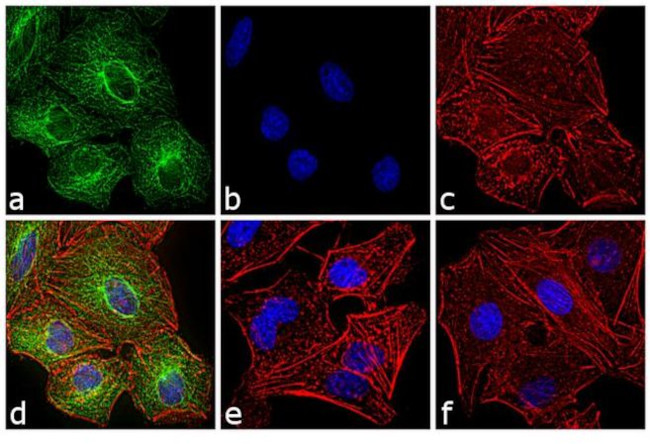 Rat IgG (H+L) Highly Cross-Adsorbed Secondary Antibody in Immunocytochemistry (ICC/IF)