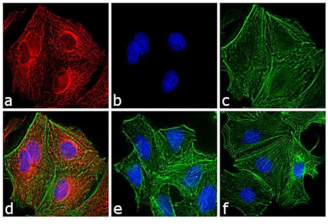 Rat IgG (H+L) Highly Cross-Adsorbed Secondary Antibody in Immunocytochemistry (ICC/IF)