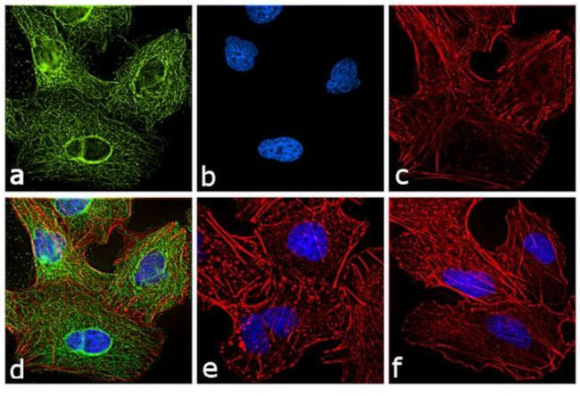 Rat IgG (H+L) Cross-Adsorbed Secondary Antibody in Immunocytochemistry (ICC/IF)