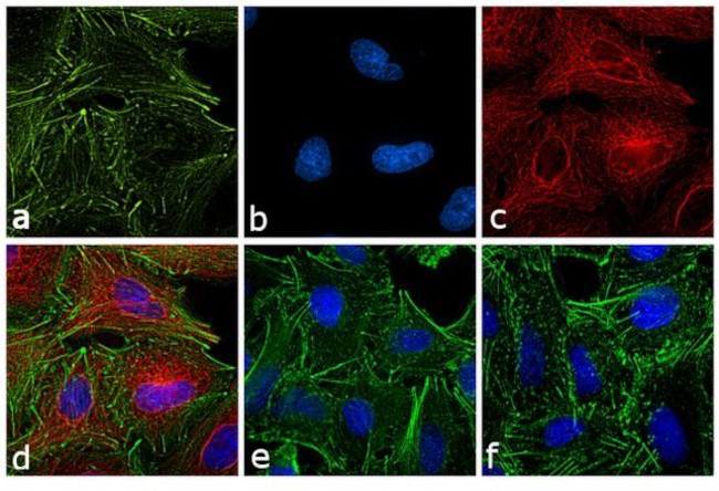 Rat IgG (H+L) Cross-Adsorbed Secondary Antibody in Immunocytochemistry (ICC/IF)