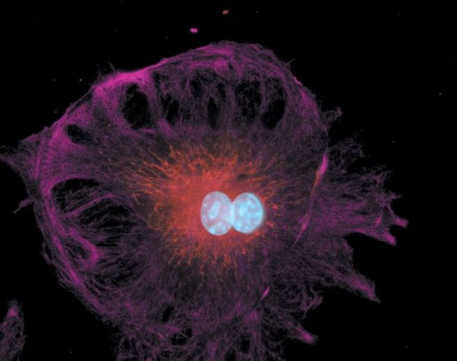 Mouse IgG (H+L) Cross-Adsorbed Secondary Antibody in Immunocytochemistry (ICC/IF)