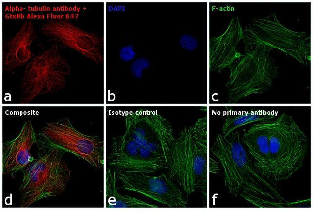 Rabbit IgG (H+L) Cross-Adsorbed Secondary Antibody in Immunocytochemistry (ICC/IF)