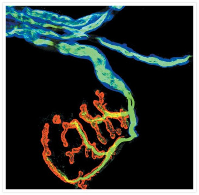 Rabbit IgG (H+L) Cross-Adsorbed Secondary Antibody in Immunocytochemistry (ICC/IF)