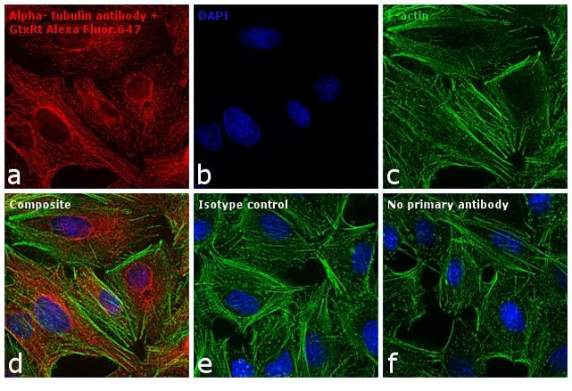 Rat IgG (H+L) Cross-Adsorbed Secondary Antibody in Immunocytochemistry (ICC/IF)