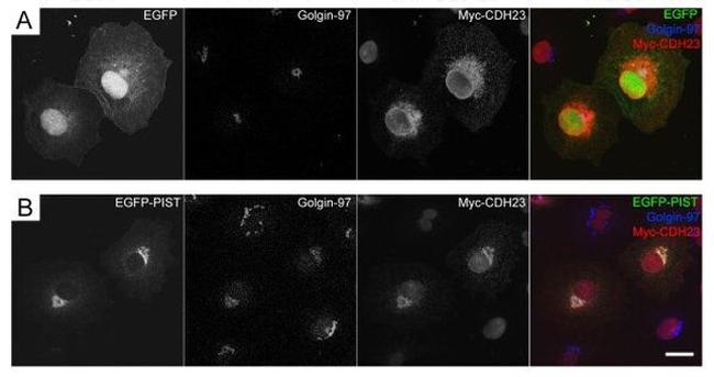 Golgin-97 Antibody in Immunohistochemistry (IHC)