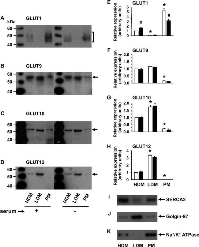 Golgin-97 Antibody in Western Blot (WB)