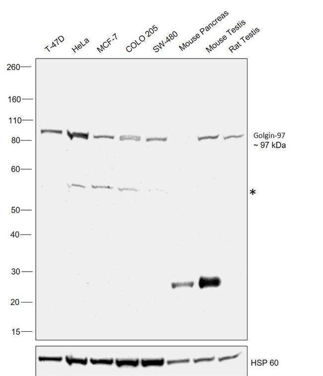 Golgin-97 Antibody in Western Blot (WB)