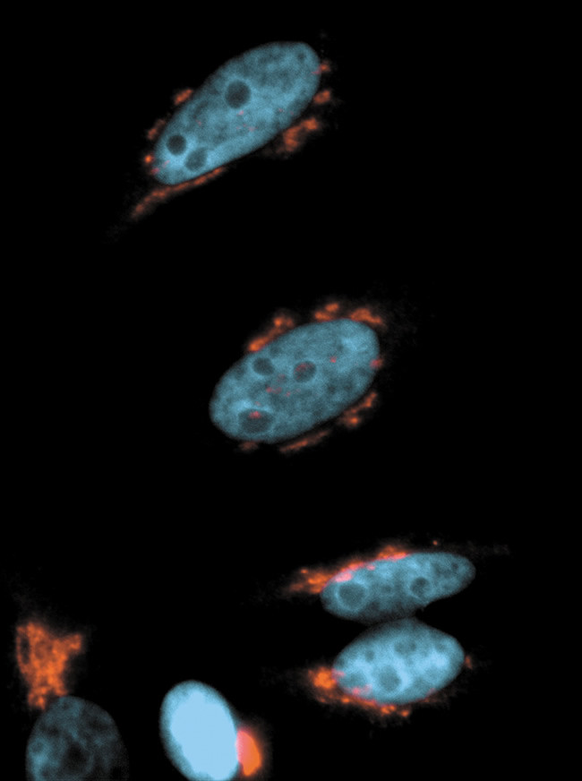 Golgin-97 Antibody in Immunocytochemistry (ICC/IF)