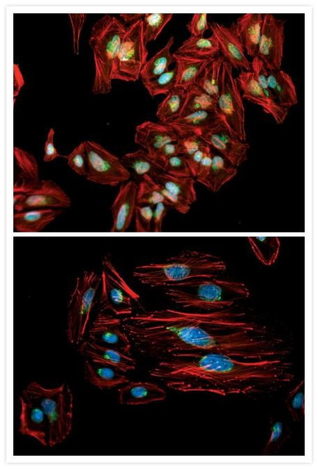 Golgin-97 Antibody in Immunocytochemistry (ICC/IF)