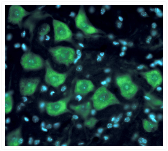 HuC/HuD Antibody in Immunohistochemistry (IHC)