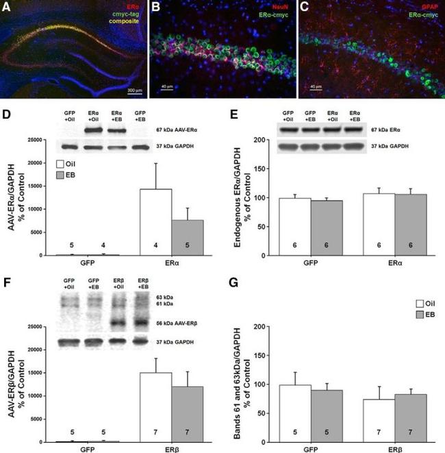 Estrogen Receptor beta Antibody in Western Blot (WB)