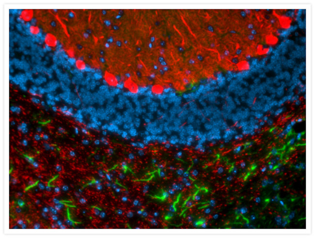 GFAP Antibody in Immunocytochemistry (ICC/IF)