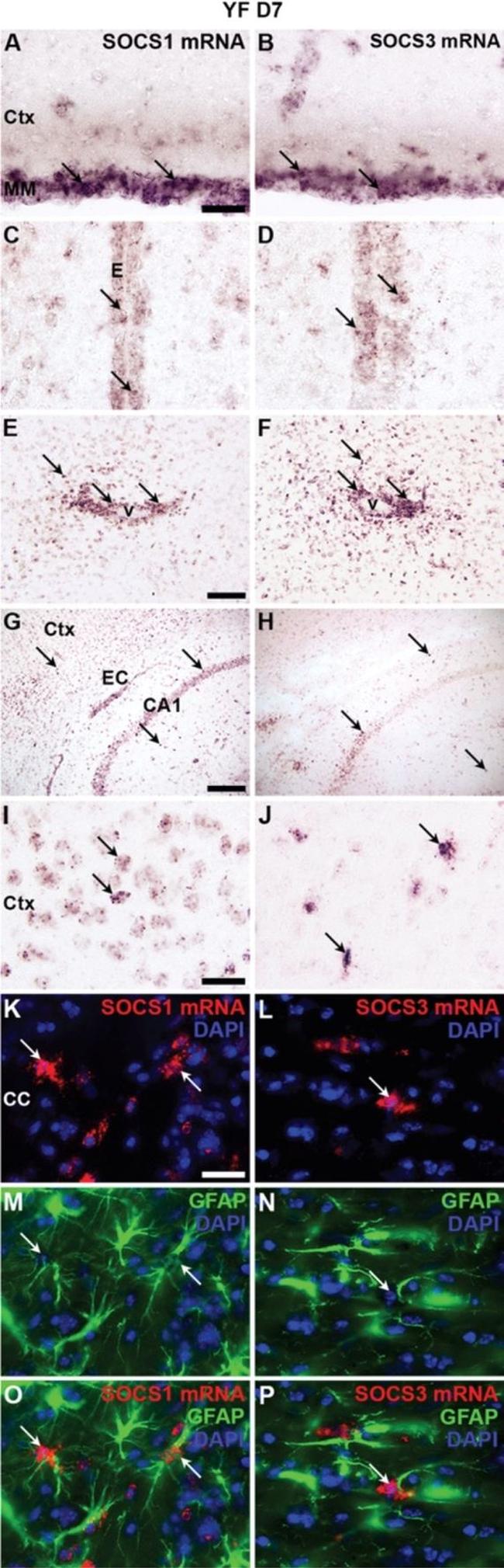 GFAP Antibody in Immunohistochemistry (IHC)