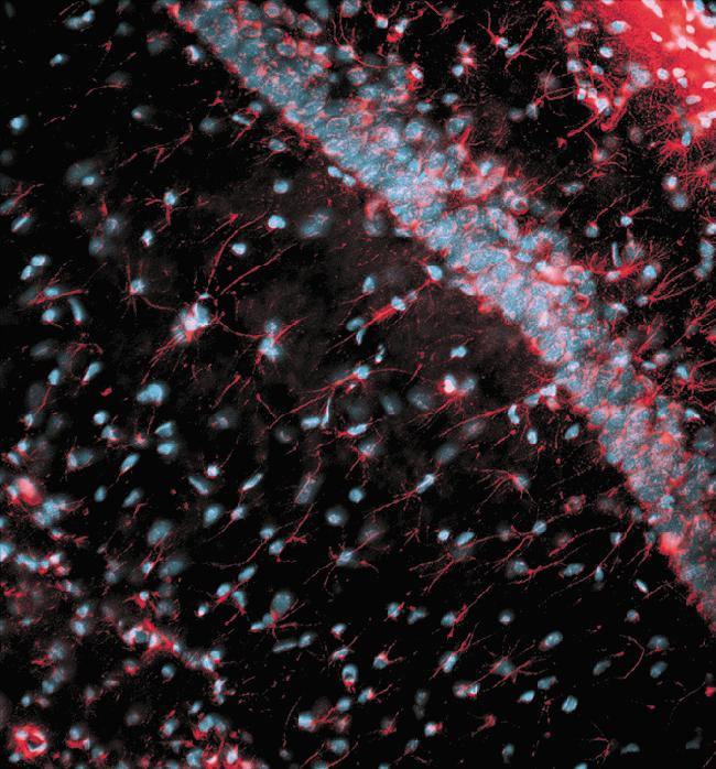 GFAP Antibody in Immunohistochemistry (Frozen) (IHC (F))