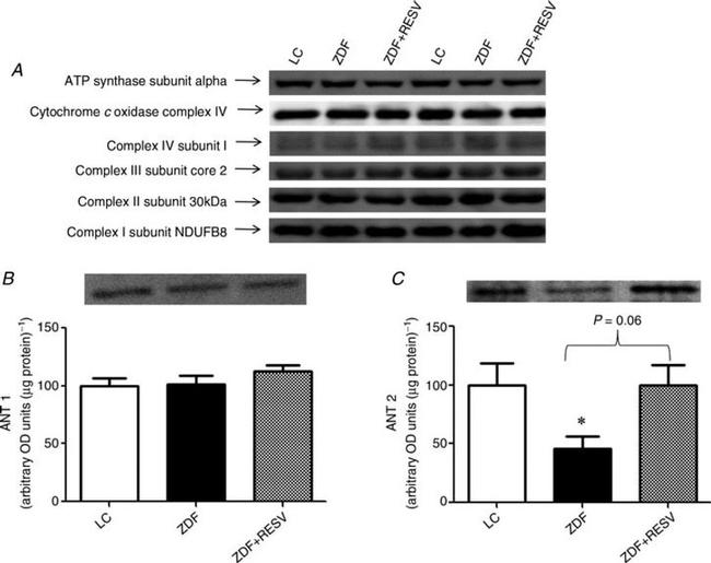 OxPhos Complex IV subunit IV Antibody in Western Blot (WB)