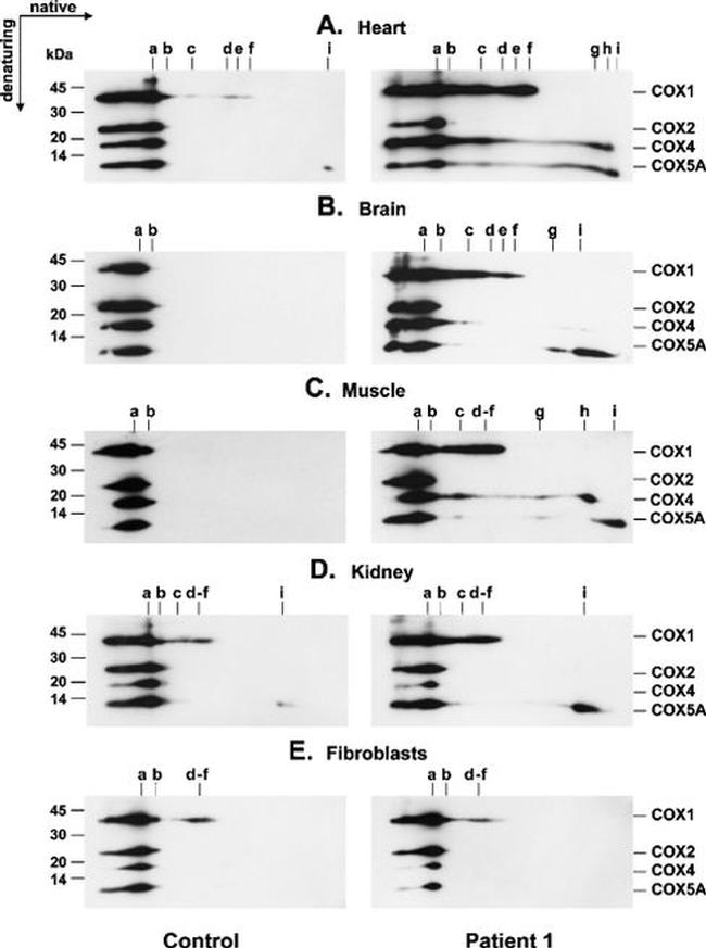 MTCO2 Antibody in Western Blot (WB)