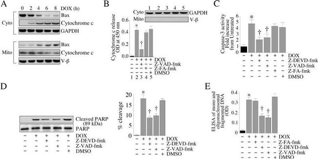 ATP Synthase beta Antibody in Western Blot (WB)