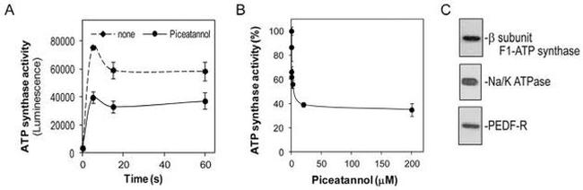 ATP Synthase beta Antibody in Western Blot (WB)