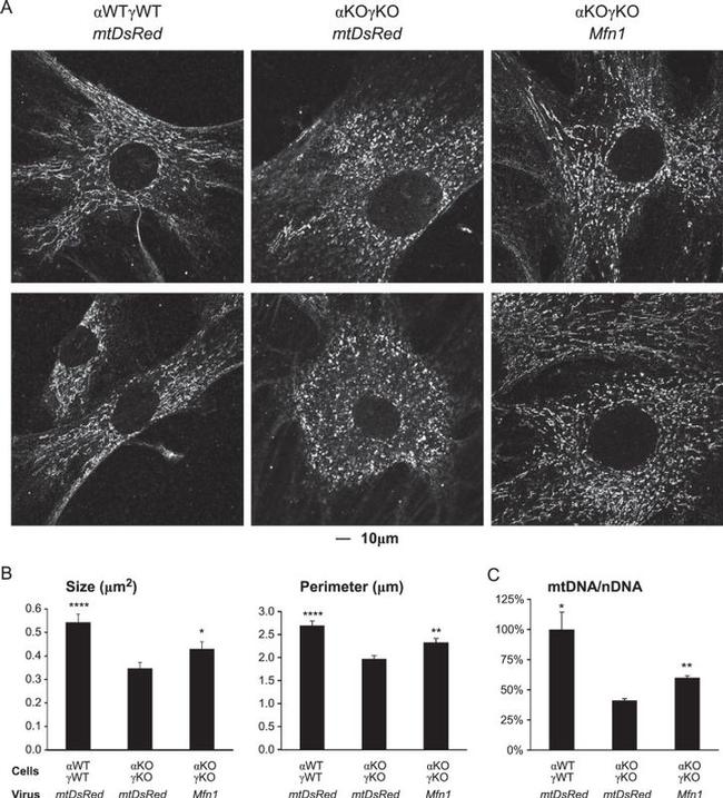 ATP Synthase beta Antibody in Immunocytochemistry (ICC/IF)