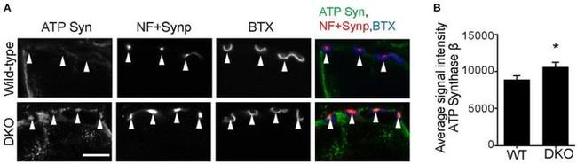 ATP Synthase beta Antibody in Immunohistochemistry (IHC)