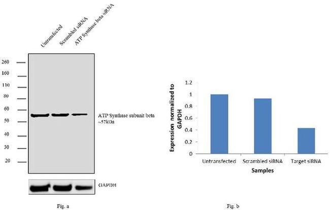 ATP Synthase beta Antibody in Western Blot (WB)