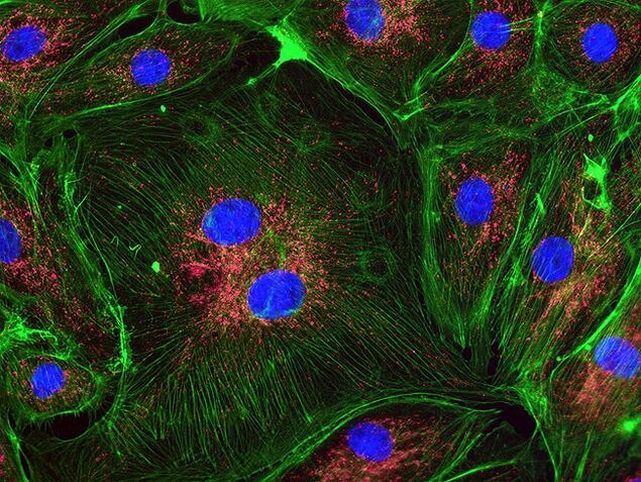 ATPIF1 Antibody in Immunocytochemistry (ICC/IF)