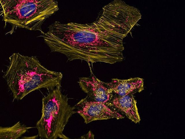 ATPIF1 Antibody in Immunocytochemistry (ICC/IF)