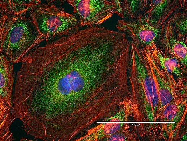 ATPIF1 Antibody in Immunocytochemistry (ICC/IF)