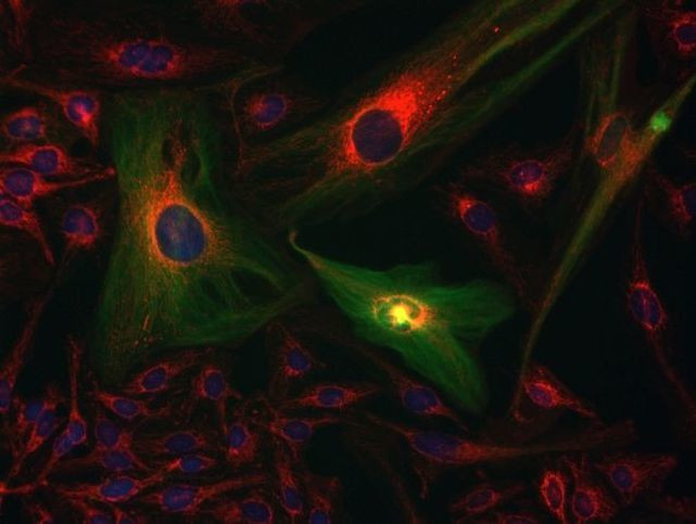 ATPIF1 Antibody in Immunocytochemistry (ICC/IF)