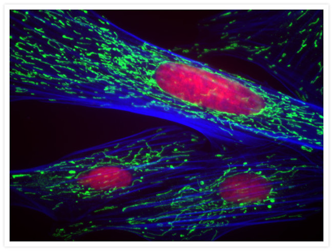 ATPIF1 Antibody in Immunocytochemistry (ICC/IF)