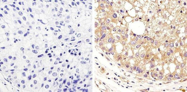 alpha Tubulin Antibody in Immunohistochemistry (Paraffin) (IHC (P))