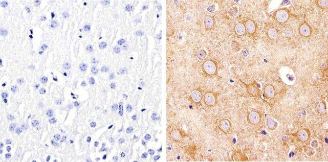 alpha Tubulin Antibody in Immunohistochemistry (Paraffin) (IHC (P))