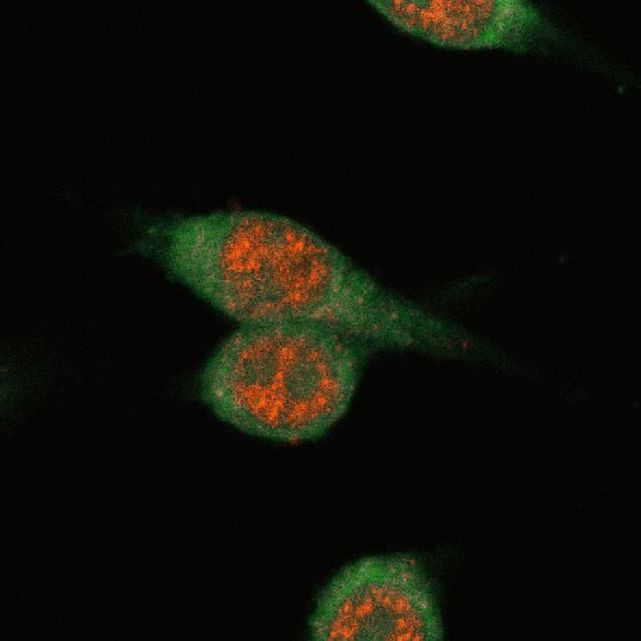 Mouse IgG (H+L) Cross-Adsorbed Secondary Antibody in Immunocytochemistry (ICC/IF)