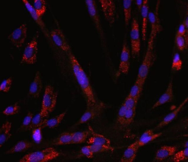 Mouse IgG (H+L) Highly Cross-Adsorbed Secondary Antibody in Immunocytochemistry (ICC/IF)