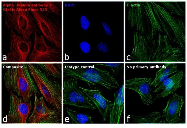 Mouse IgG (H+L) Highly Cross-Adsorbed Secondary Antibody in Immunocytochemistry (ICC/IF)