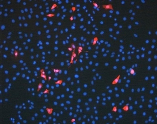 Mouse IgG (H+L) Highly Cross-Adsorbed Secondary Antibody in Immunocytochemistry (ICC/IF)