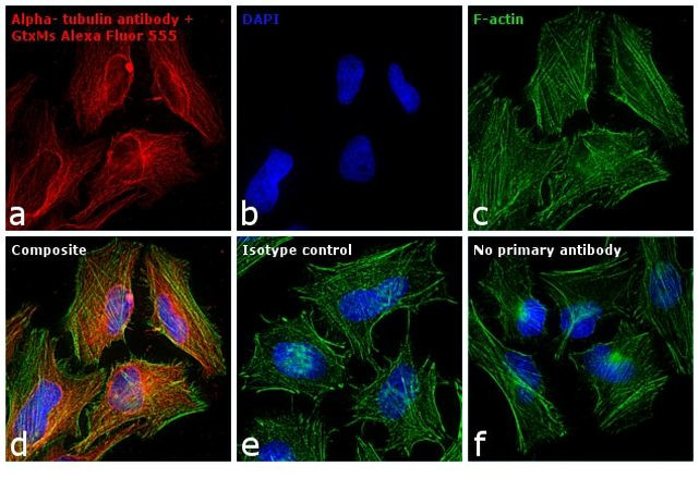 Mouse IgG (H+L) Cross-Adsorbed Secondary Antibody in Immunocytochemistry (ICC/IF)