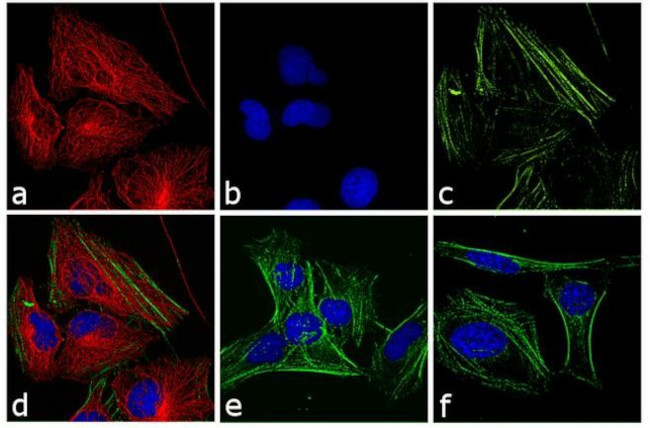 Rabbit IgG (H+L) Cross-Adsorbed Secondary Antibody in Immunocytochemistry (ICC/IF)