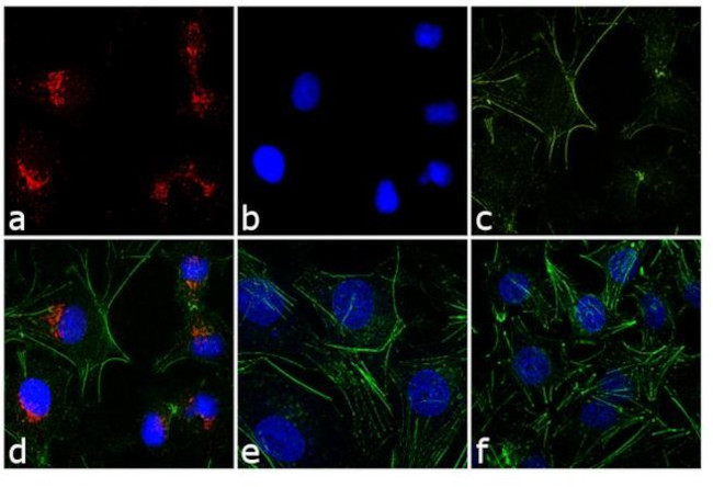 Rabbit IgG (H+L) Highly Cross-Adsorbed Secondary Antibody in Immunocytochemistry (ICC/IF)