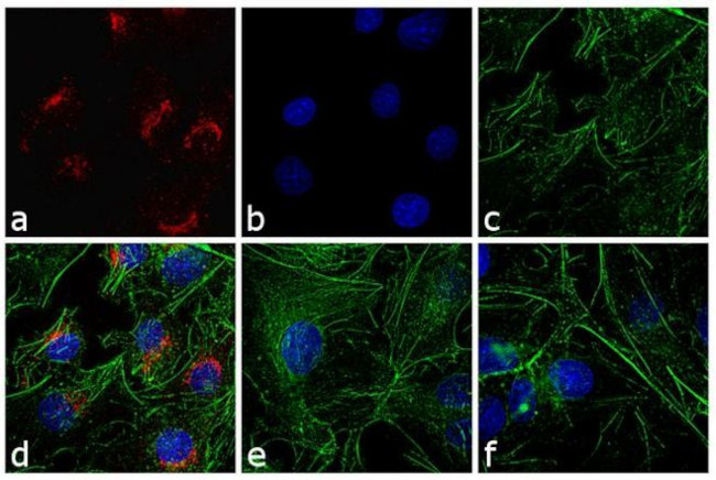 Rabbit IgG (H+L) Cross-Adsorbed Secondary Antibody in Immunocytochemistry (ICC/IF)