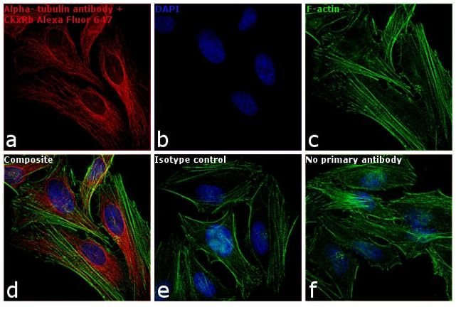 Rabbit IgG (H+L) Cross-Adsorbed Secondary Antibody in Immunocytochemistry (ICC/IF)