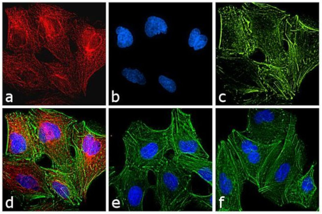 Rat IgG (H+L) Cross-Adsorbed Secondary Antibody in Immunocytochemistry (ICC/IF)